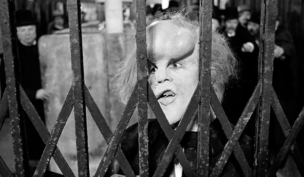 L'uomo elefante guarda attraverso le sbarre