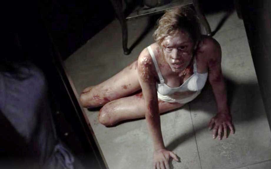 a woman with disfigured flesh