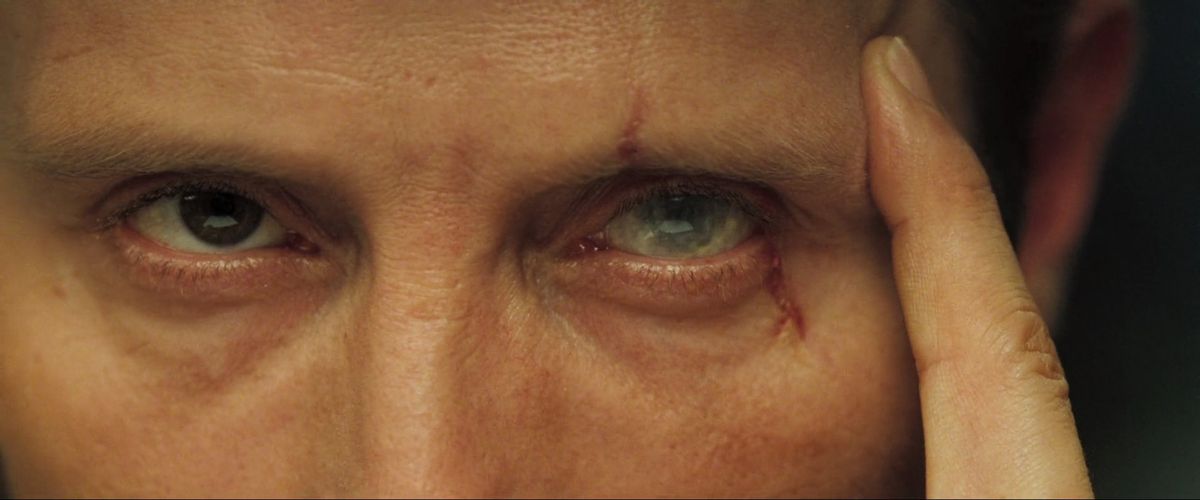 Le Chiffre holds a finger against his scarred eye in Casino Royale