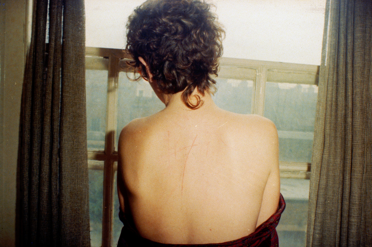 Una Nan Goldin di mezza età con i capelli corti in piedi davanti a una finestra, distolta dalla telecamera, che mostra diverse cicatrici sulla schiena in Tutta la bellezza e lo spargimento di sangue